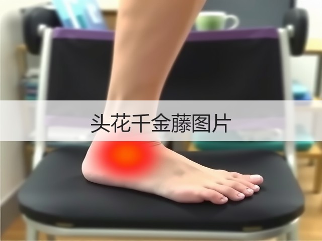 头花千金藤图片 头花千金藤图片