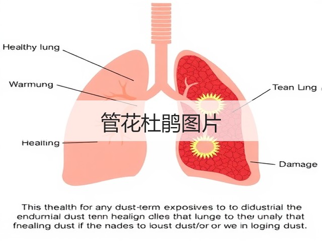 管花杜鹃图片 管花杜鹃图片