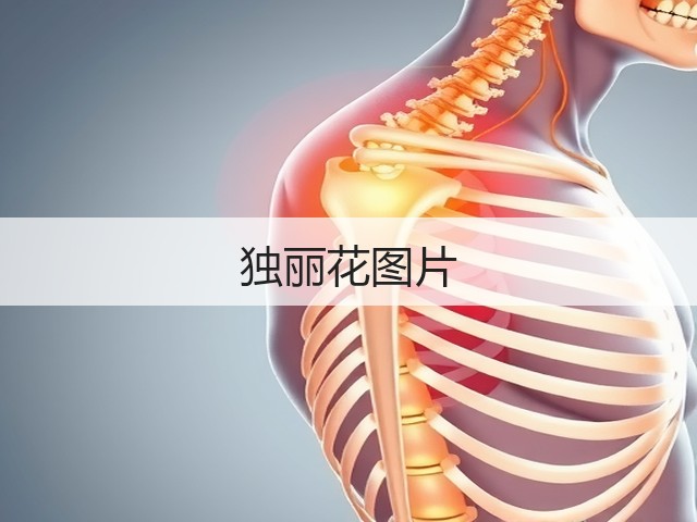 独丽花图片
